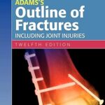 Adams's Outline of Fractures 12th Edition by David L. Hamblen PhD DSc FRCS(Edinburgh England Glasgow) (Author), Hamish Simpson DM(Oxon) FRCS(Ed & England) (Author)